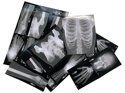 X Rays Props, Prop Hire